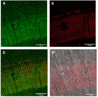 Pectic polysaccharide, beta-1,4-galactan (monoclonal, clone LM5) in the group Antibodies Plant/Algal / Cell Wall / Dr. Knox collection, University of Leeds at Agrisera AB (Antibodies for research) (AS18 4197-1ml)